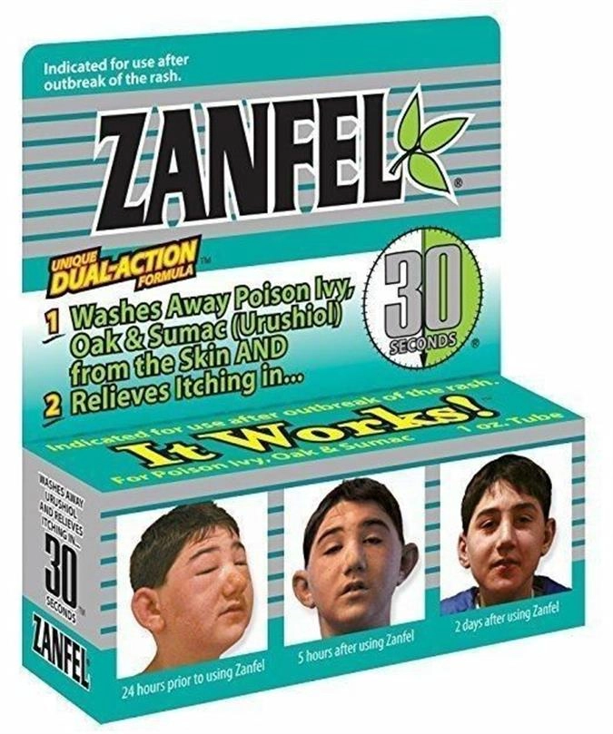 Zanfel NG